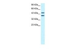 NY-REN-50 antigen Rabbit anti-Human, Polyclonal, Novus Biologicals 0.1 mL | Buy Online | Novus Biologicals | Fisher Scientific